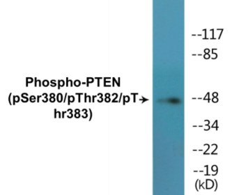 Phospho-PTEN (Ser380/Thr382/Thr383) Colorimetric Cell-Based ELISA Kit