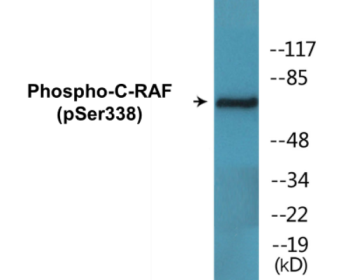 Phospho-C-RAF (Ser338) Colorimetric Cell-Based ELISA Kit