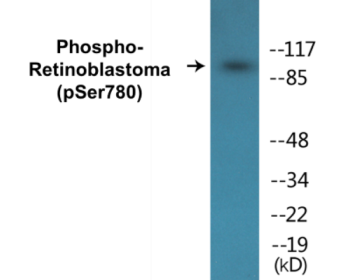 Phospho-Retinoblastoma (Ser780) Colorimetric Cell-Based ELISA Kit