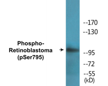 Phospho-Retinoblastoma (Ser795) Colorimetric Cell-Based ELISA Kit
