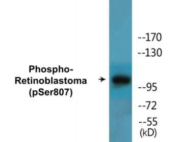 Phospho-Retinoblastoma (Ser807) Colorimetric Cell-Based ELISA Kit