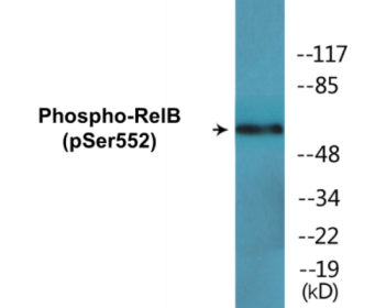 Phospho-RelB (Ser552) Colorimetric Cell-Based ELISA Kit