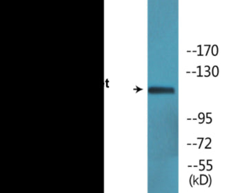 Phospho-Ret (Tyr1062) Colorimetric Cell-Based ELISA Kit