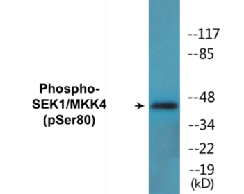 Phospho-SEK1/MKK4 (Ser80) Colorimetric Cell-Based ELISA Kit