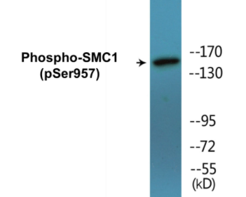 Phospho-SMC1 (Ser957) Colorimetric Cell-Based ELISA Kit