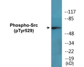 Phospho-Src (Tyr529) Colorimetric Cell-Based ELISA Kit