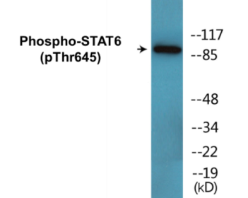 Phospho-STAT5A/B (Tyr694) Colorimetric Cell-Based ELISA Kit