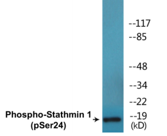Phospho-Stathmin 1 (Ser24) Colorimetric Cell-Based ELISA Kit