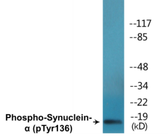 Phospho-Synuclein-alpha (Tyr136) Colorimetric Cell-Based ELISA Kit
