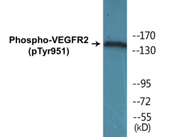 Phospho-VEGFR2 (Tyr951) Colorimetric Cell-Based ELISA Kit