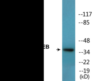 Phospho-CREB (Thr100) Colorimetric Cell-Based ELISA Kit