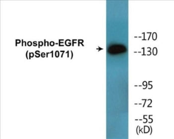 Phospho-EGFR (Ser1071) Colorimetric Cell-Based ELISA Kit