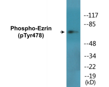 Phospho-Ezrin (Tyr478) Colorimetric Cell-Based ELISA Kit