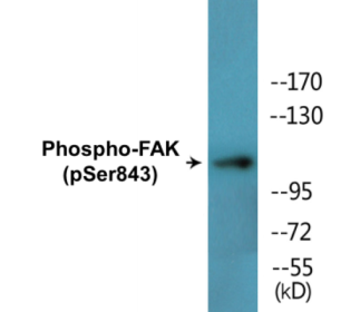 Phospho-FAK (Ser843) Colorimetric Cell-Based ELISA Kit