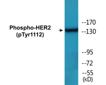 Phospho-HER2 (Tyr1112) Colorimetric Cell-Based ELISA Kit