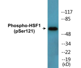 Phospho-HSF1 (Ser121) Colorimetric Cell-Based ELISA Kit