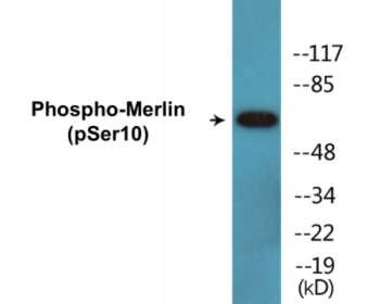 Phospho-Merlin (Ser10) Colorimetric Cell-Based ELISA Kit