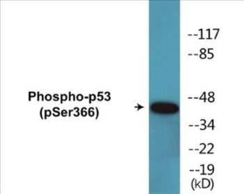 Phospho-p53 (Ser366) Colorimetric Cell-Based ELISA Kit