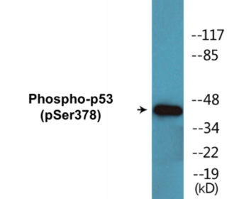 Phospho-p53 (Ser378) Colorimetric Cell-Based ELISA Kit