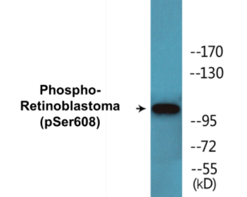 Phospho-Retinoblastoma (Ser608) Colorimetric Cell-Based ELISA Kit