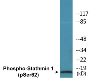 Phospho-Stathmin 1 (Ser62) Colorimetric Cell-Based ELISA Kit