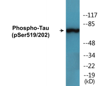 Phospho-Tau (Ser519/202) Colorimetric Cell-Based ELISA Kit