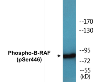 Phospho-B-RAF (Ser446) Colorimetric Cell-Based ELISA Kit