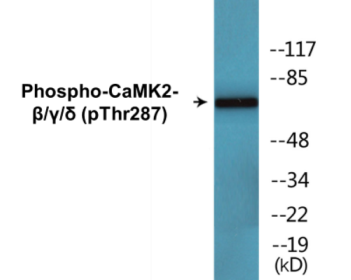 Phospho-CaMK2-beta/gamma/delta (Thr287) Colorimetric Cell-Based ELISA Kit