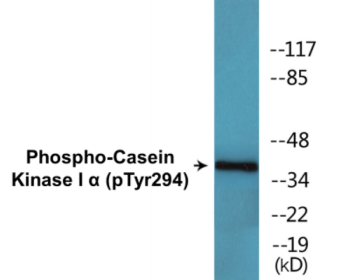 Phospho-Casein Kinase I alpha (Tyr294) Colorimetric Cell-Based ELISA Kit