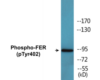 Phospho-FER (Tyr402) Colorimetric Cell-Based ELISA Kit