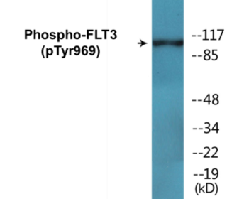 Phospho-FLT3 (Tyr969) Colorimetric Cell-Based ELISA Kit