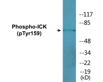 Phospho-ICK (Tyr159) Colorimetric Cell-Based ELISA Kit