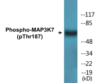 Phospho-MAP3K7 (Thr187) Colorimetric Cell-Based ELISA Kit