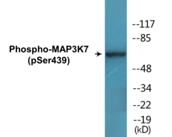 Phospho-MAP3K7 (Ser439) Colorimetric Cell-Based ELISA Kit