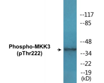 Phospho-MKK3 (Thr222) Colorimetric Cell-Based ELISA Kit