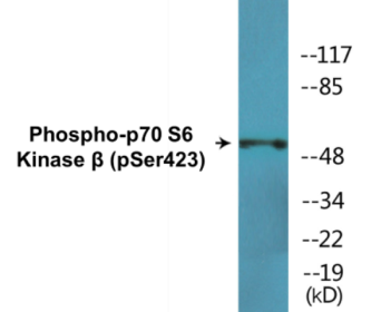Phospho-p70 S6 Kinase beta (Ser423) Colorimetric Cell-Based ELISA Kit