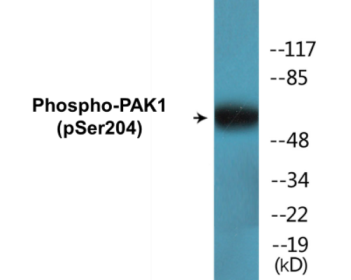 Phospho-PAK1 (Ser204) Colorimetric Cell-Based ELISA Kit