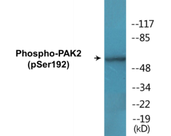 Phospho-PAK2 (Ser192) Colorimetric Cell-Based ELISA Kit