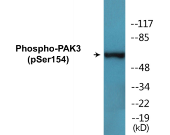 Phospho-PAK3 (Ser154) Colorimetric Cell-Based ELISA Kit