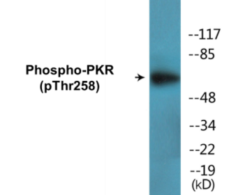 Phospho-PKR (Thr258) Colorimetric Cell-Based ELISA Kit