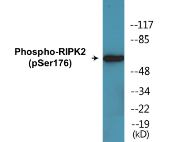 Phospho-RIPK2 (Ser176) Colorimetric Cell-Based ELISA Kit