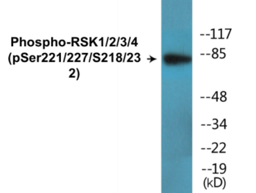 Phospho-RSK1/2/3/4 (Ser221/227/S218/232) Colorimetric Cell-Based ELISA Kit