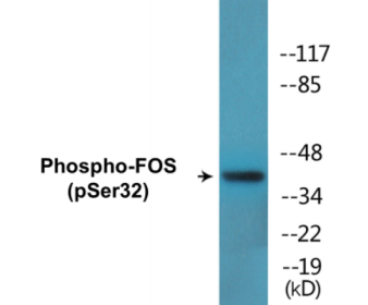 Phospho-FOS (Ser32) Colorimetric Cell-Based ELISA Kit