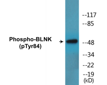 Phospho-BLNK (Tyr84) Colorimetric Cell-Based ELISA Kit