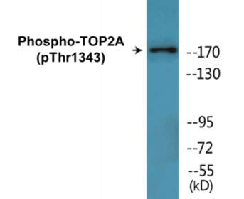 Phospho-TOP2A (Thr1343) Colorimetric Cell-Based ELISA Kit