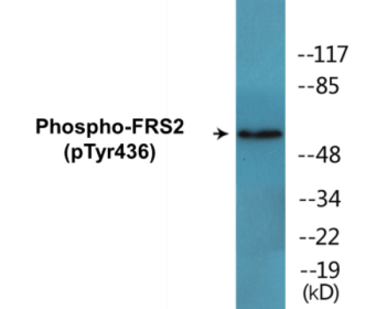 Phospho-FRS2 (Tyr436) Colorimetric Cell-Based ELISA Kit