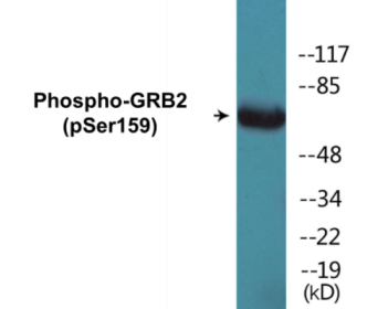 Phospho-GRB2 (Ser159) Colorimetric Cell-Based ELISA Kit