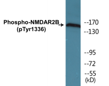 Phospho-NMDAR2B (Tyr1336) Colorimetric Cell-Based ELISA Kit
