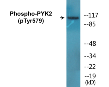 Phospho-PYK2 (Tyr579) Colorimetric Cell-Based ELISA Kit