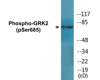 Phospho-GRK2 (Ser685) Colorimetric Cell-Based ELISA Kit